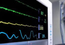 Microscópio com IA detecta infarto e AVC antes de acontecerem; criado no Japão