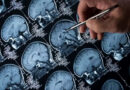Cientistas conseguem reverter Alzheimer com terapia inovadora em camundongos
