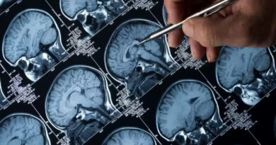 Cientistas conseguem reverter Alzheimer com terapia inovadora em camundongos